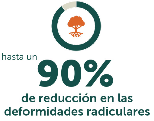 Ellepot 90% de reducción en las deformidades radiculares